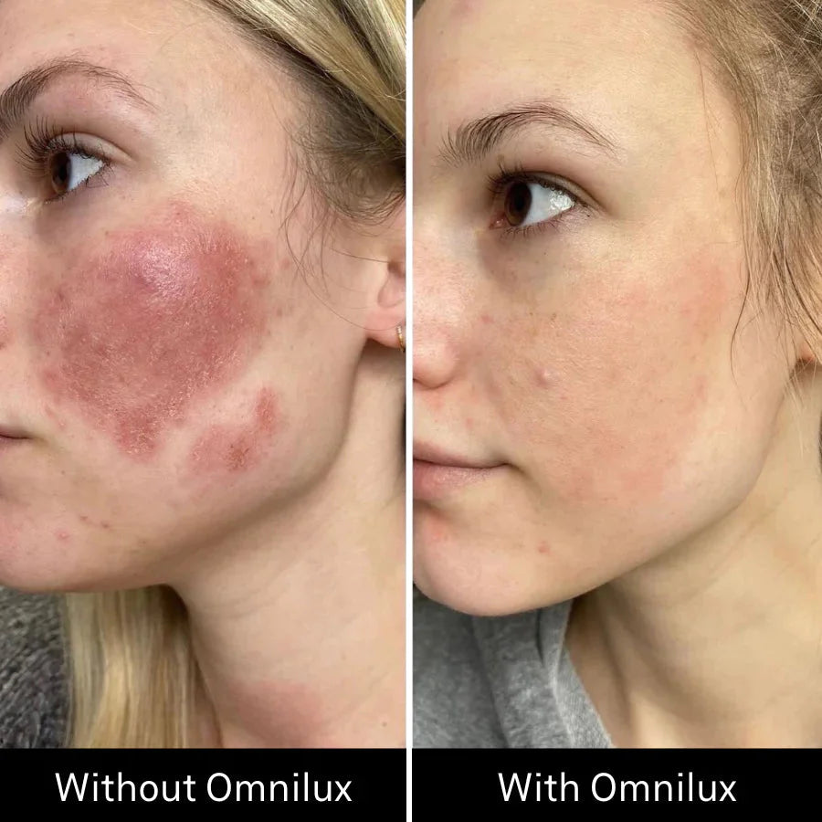 OMNILUX CONTOUR FACE CANADA