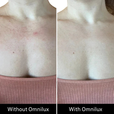 Omnilux Contour™ NECK & DÉCOLLETÉ