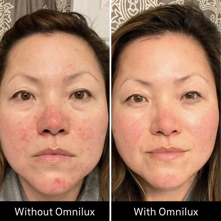 OMNILUX CONTOUR FACE CANADA