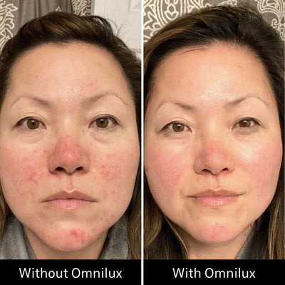 OMNILUX CONTOUR FACE CANADA