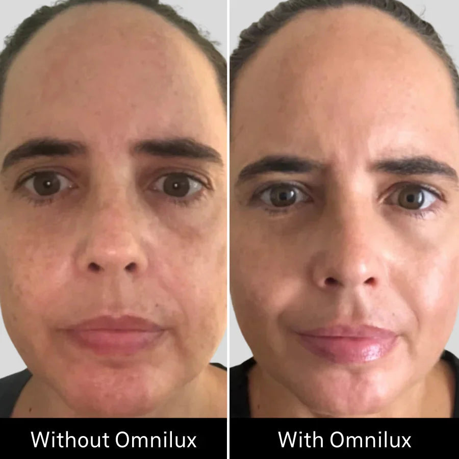 OMNILUX CONTOUR FACE CANADA